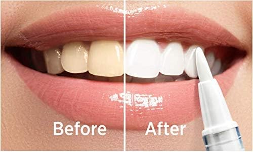 Kit de Blanqueamiento Dental LED